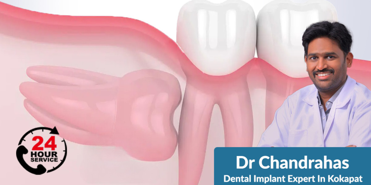 The Key To Lasting Smiles: Why Dental Doctor Chandrahas is Your Best Choice